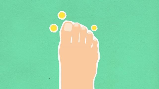 How to Cure Fungal Infection on Skin Naturally?