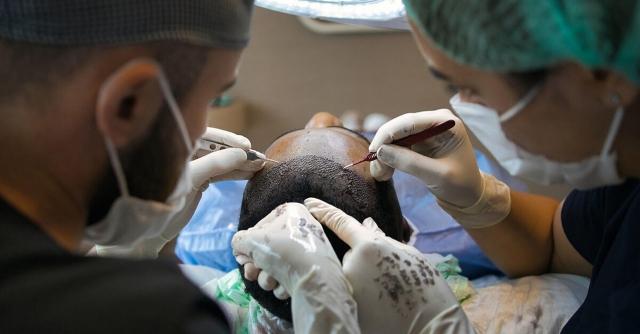 Exploring Affordable Hair Restoration Solutions in Bangkok: Is FUT Right for You?