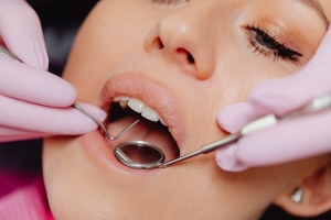 About Dental Implants About Dental Implants